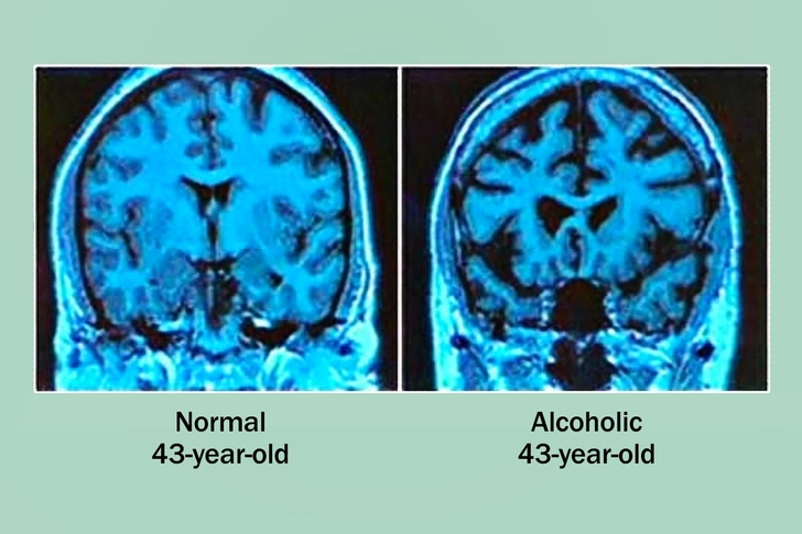 It Can Slow Your Brain It Can Slow Your Brain