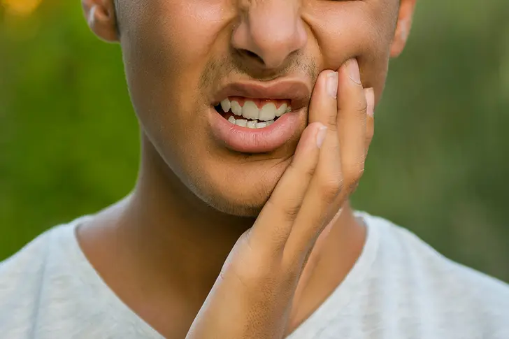 What Are Canker Sores? What Are Canker Sores?