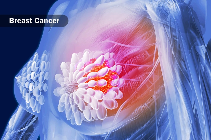 Does CBD Help Cancer?