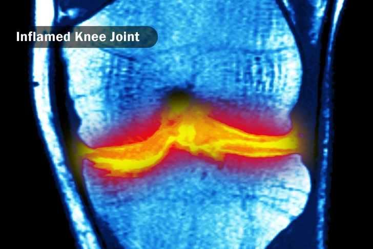 Does It Help Inflammation?