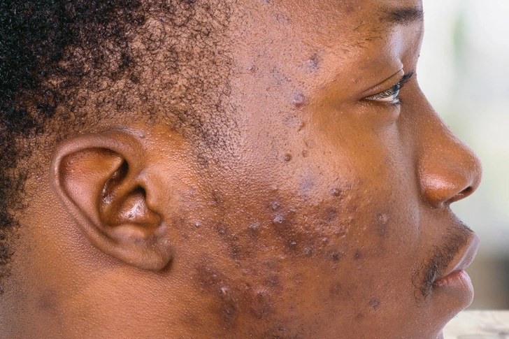 Is It Good for Your Skin? Is It Good for Your Skin?