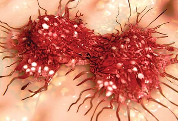 HPV and Cancer