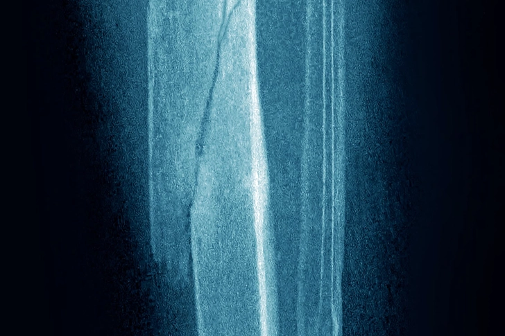 Benefit: Strengthens Bones