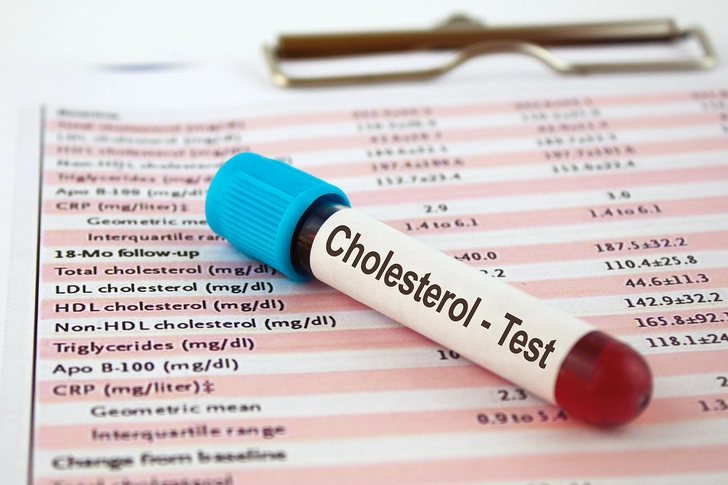 Is Cholesterol a Problem? Is Cholesterol a Problem?