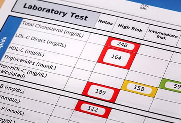 What Do the Results Mean? What Do the Results Mean?