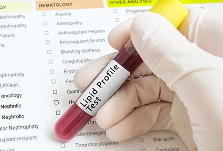 What's a Lipid Profile? What's a Lipid Profile?