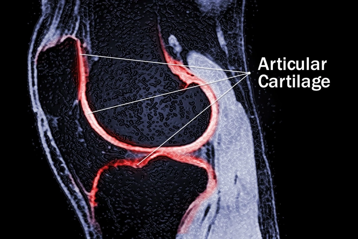 Articular Cartilage Articular Cartilage