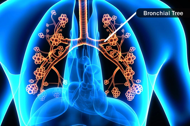 The Bronchial Tree