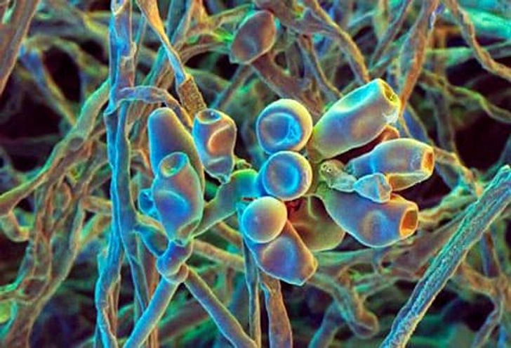 6. Mold