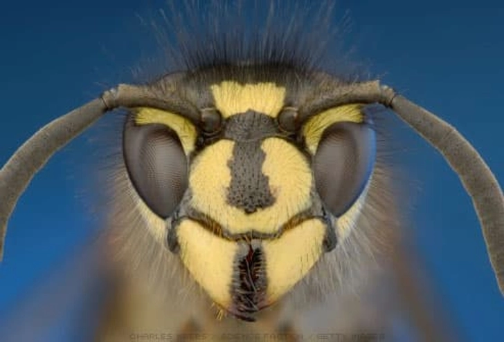 5. Insect Stings