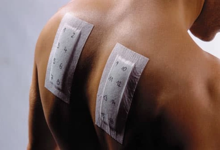 You Consider Seeing an Allergist
