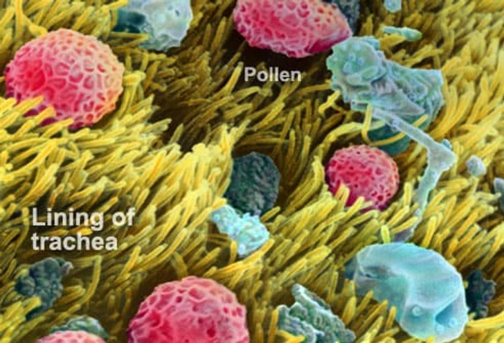 Your Immune Response Kicks In Your Immune Response Kicks In