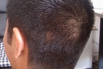 Try Scalp Cream Try Scalp Cream