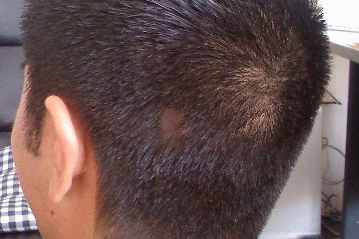 Try Scalp Cream Try Scalp Cream