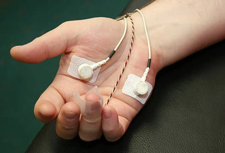 Biofeedback Biofeedback