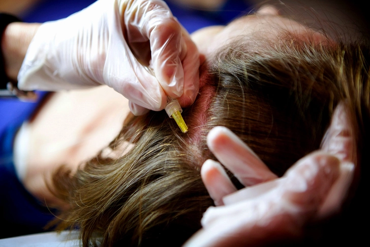 Platelet-Rich Plasma (PRP) Platelet-Rich Plasma (PRP)