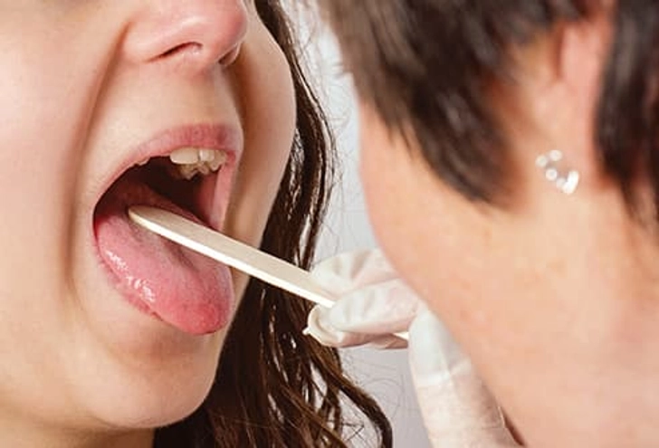 Lingering Sore Throat