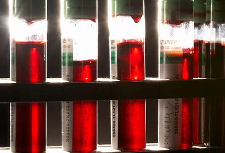 Diagnosis: Complete Blood Count