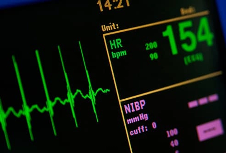 Is It a Heart Attack?