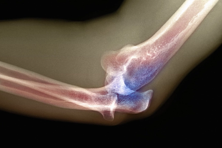 Dislocation