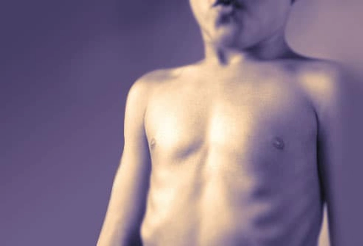 Chest and Neck Retractions