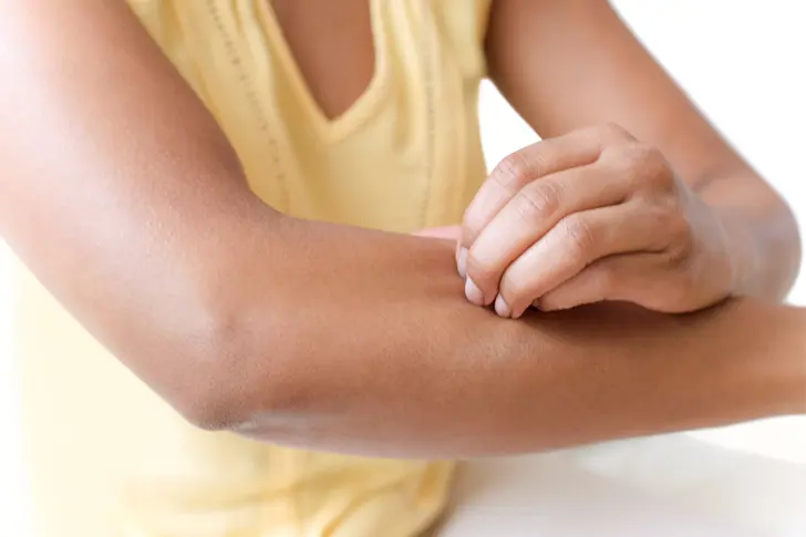 What Is Sensitive Skin?
