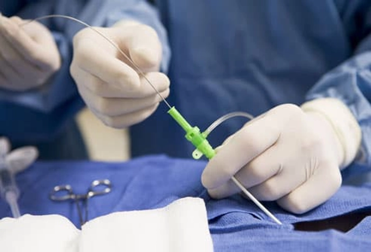 Ablation