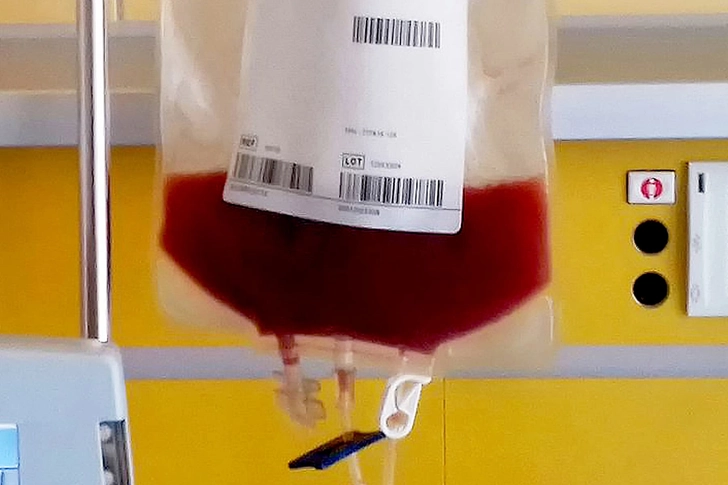 Stem Cell Transplant