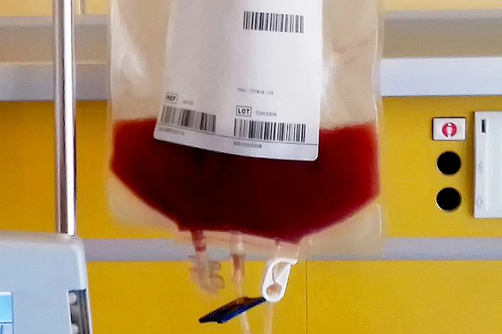 Stem Cell Transplant Stem Cell Transplant