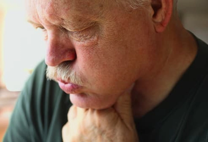 Acid Reflux or Heartburn Acid Reflux or Heartburn