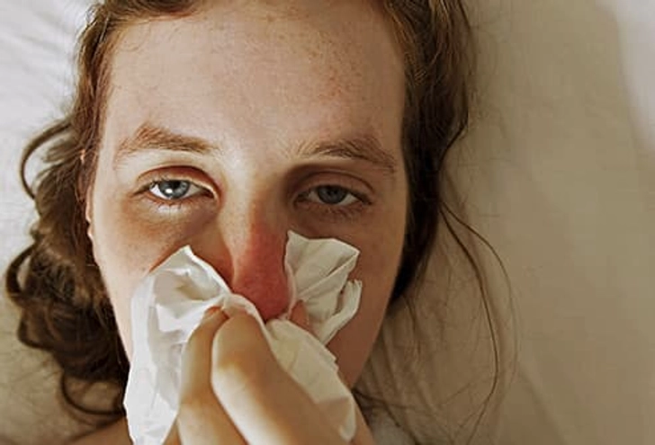 The Common Cold The Common Cold