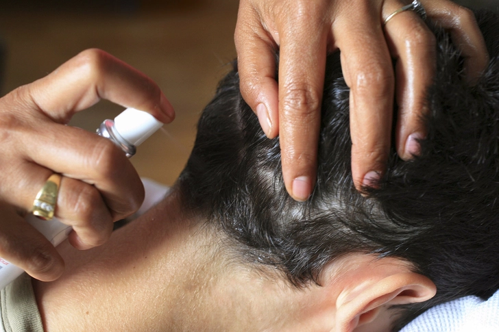 Head Lice Remedies