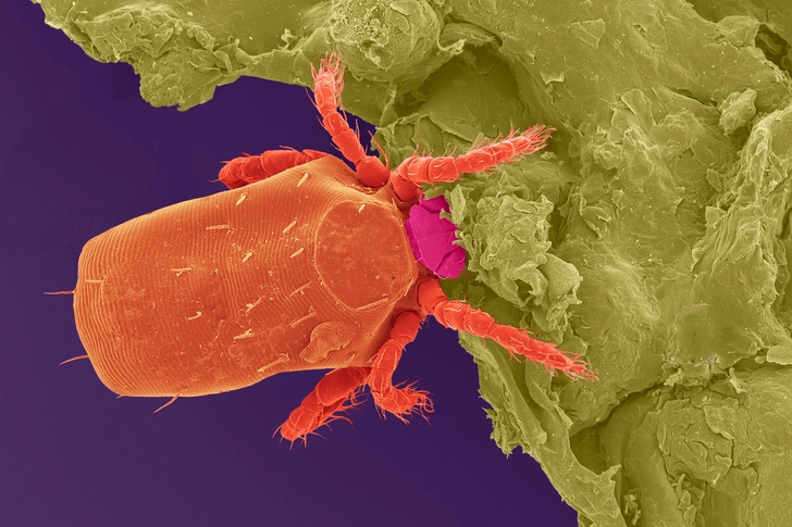 Chiggers: Itchy!