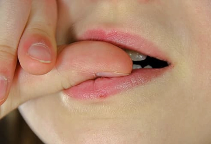Bite Your Nails