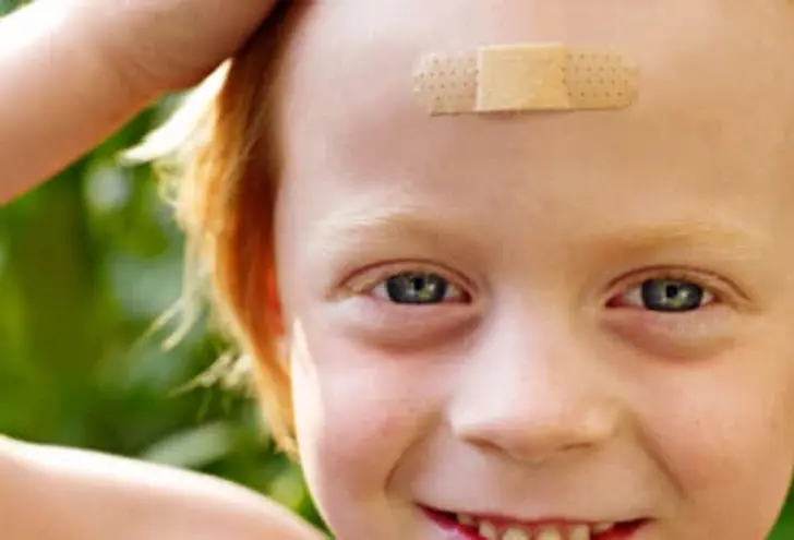 Scratches and Cuts on the Face Scratches and Cuts on the Face