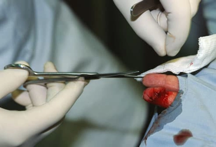 Watch Surgical Wounds for Infection Watch Surgical Wounds for Infection