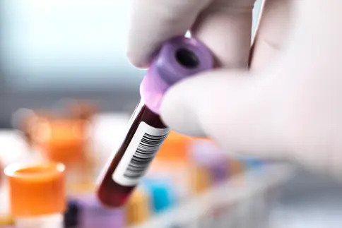 photo of blood vial