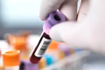 Many Men Don’t Know About PSA Tests Many Men Don’t Know About PSA Tests