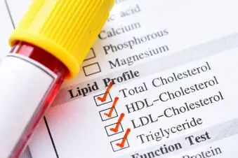 photo of lipid panel