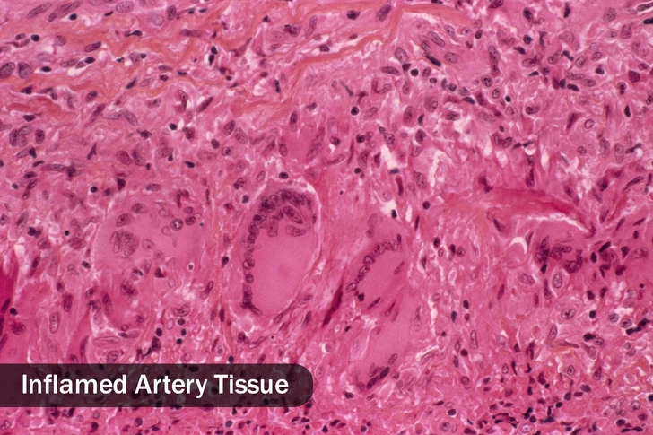 It’s Good for Inflammation It’s Good for Inflammation