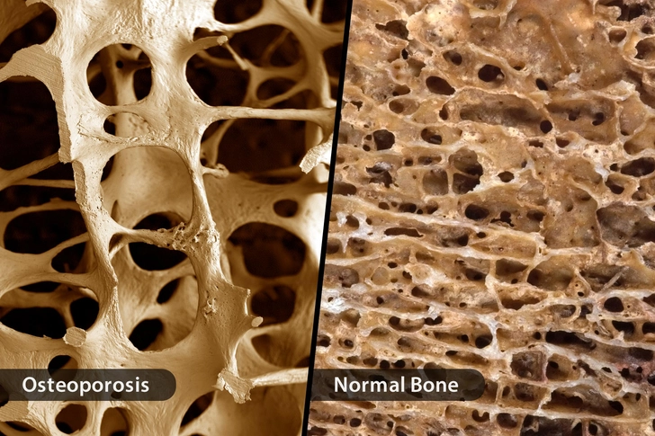 Your Bones Get Stronger Your Bones Get Stronger