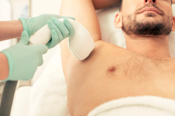 Laser Hair Removal