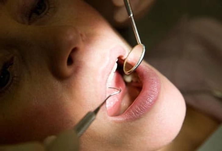 Choose the Right Dentist