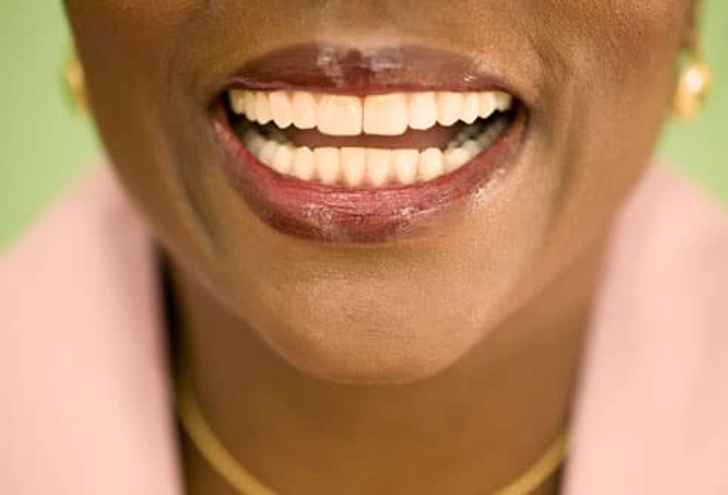 Bonding: A Small Fix for Teeth