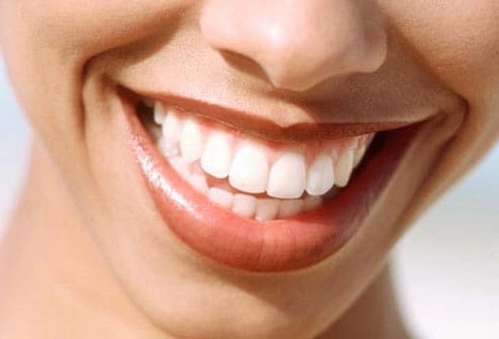 Correct a Gummy Smile