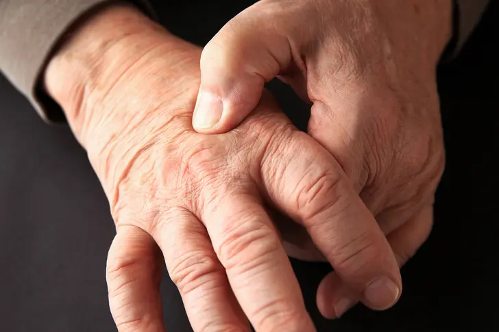 Beyond Joint Pain