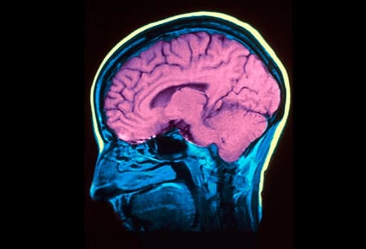 What Are the Causes?