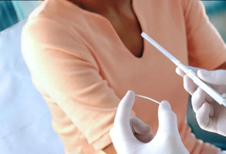 Birth Control Implant