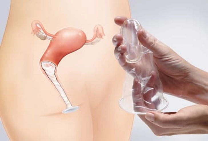 Female Condom Female Condom