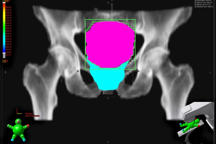Treatment: Radiation Treatment: Radiation